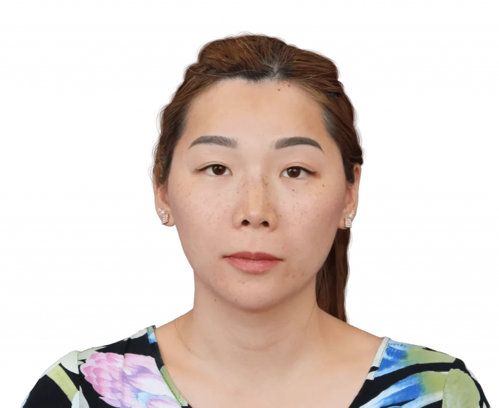 harriet-after-front — Facialteam Frontal picture taken from Harriet after surgery