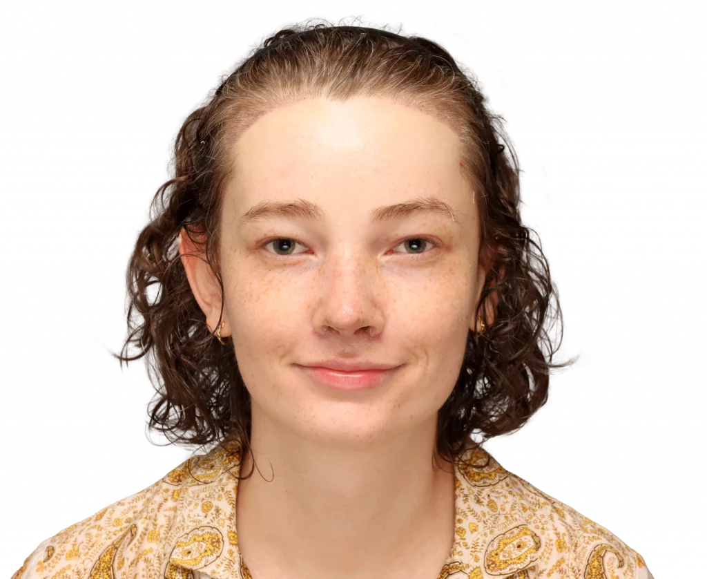 Alina-After-Front — Facialteam