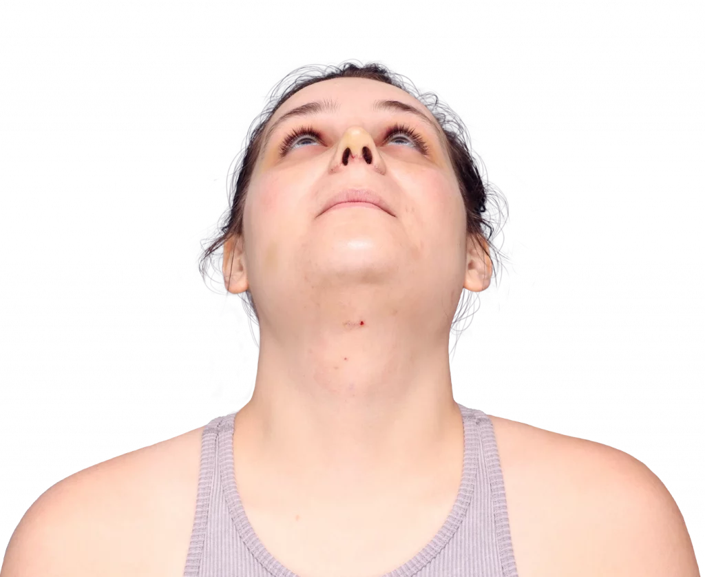 alex-after-up — Facialteam