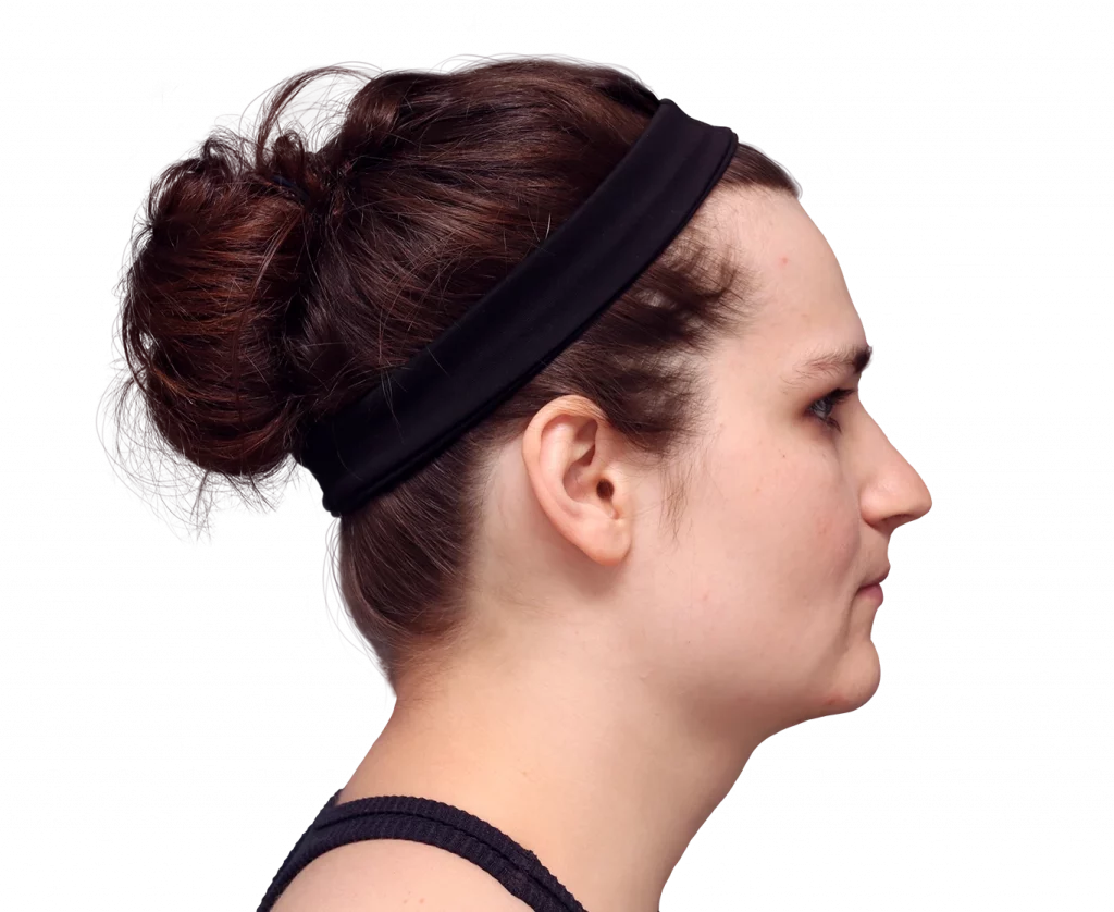 alex-before-right — Facialteam