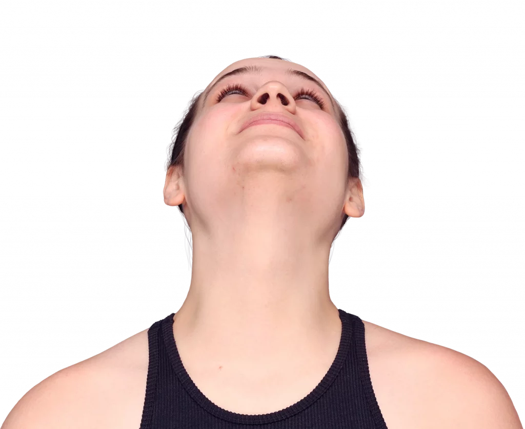 alex-before-up — Facialteam