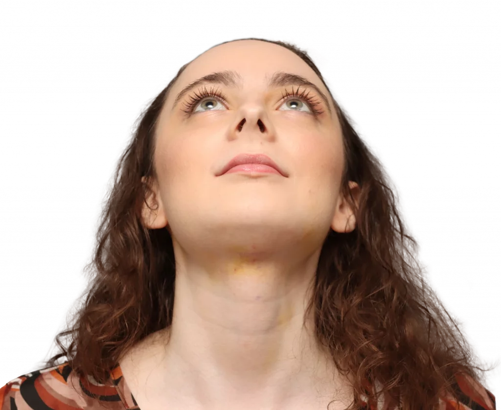 Frontaufnahme von Alex M aus leicht erhöhtem Winkel nach der Operation.