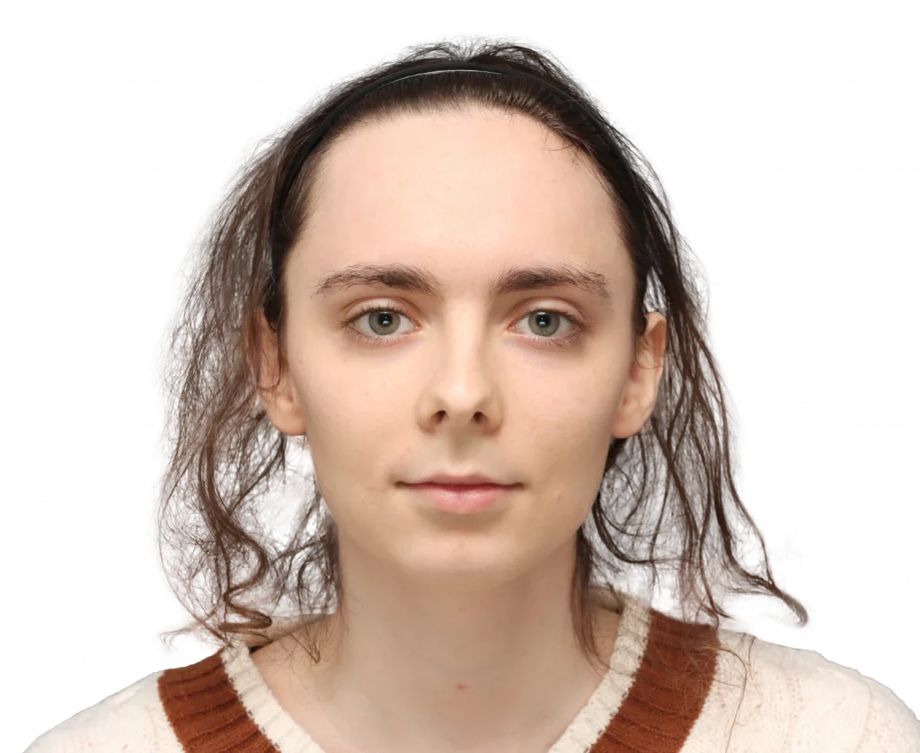 Frontansicht von Alex M von der Operation.