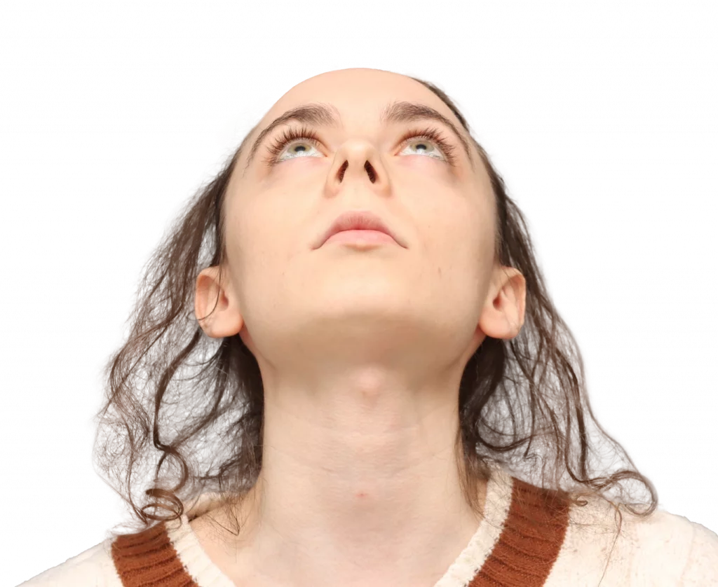 Frontaufnahme von Alex M aus leicht erhöhtem Winkel von der Operation.