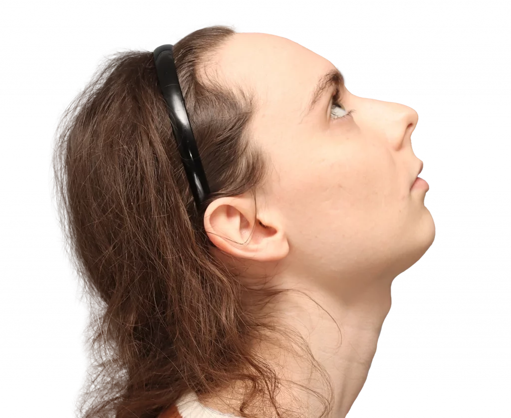 Rechte Profilaufnahme aus leicht erhöhter Perspektive von Alex M von der Operation.