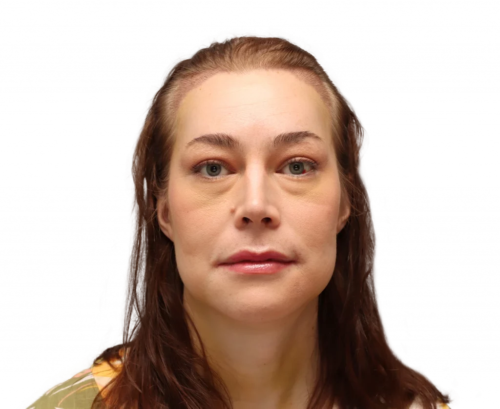 Frontale Profilaufnahme von Juuli nach der Operation.