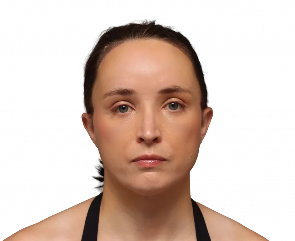 Frontalansicht von Erin nach der Operation.