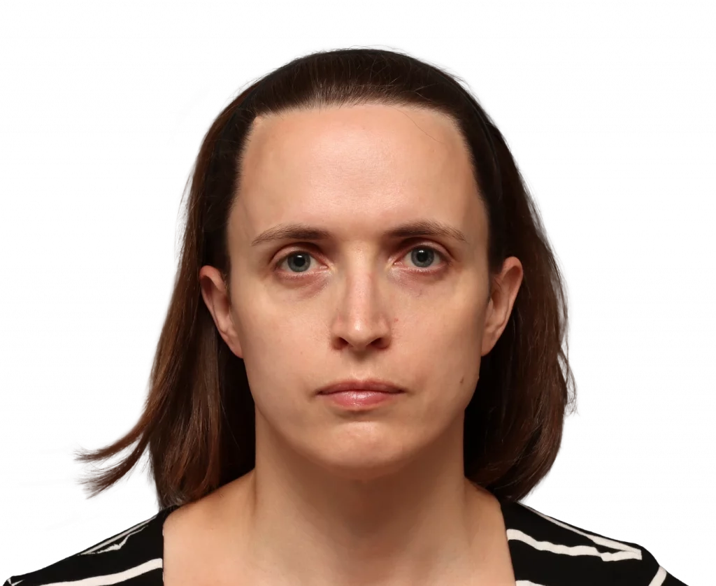 Frontalansicht von Erin vor der Operation.