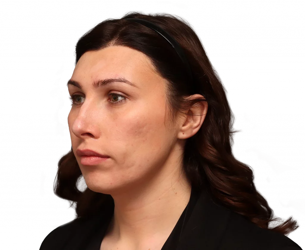 Close-up profile of a woman with dark hair wearing a black headband and blazer, looking to the left.