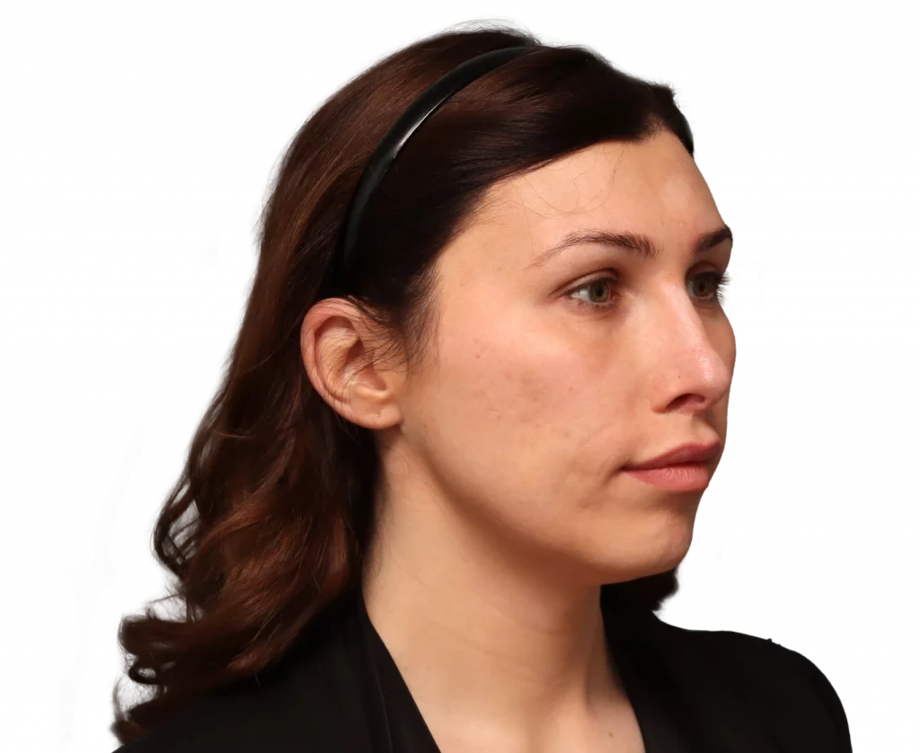 Side profile of a woman wearing a black headband, facing right.