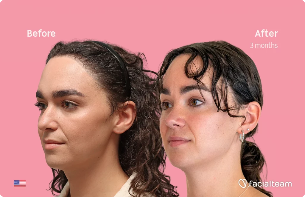 Side-by-side before-and-after portrait showing two women on a pink background, labeled 'Before' and 'After 3 months' (facial treatment result).