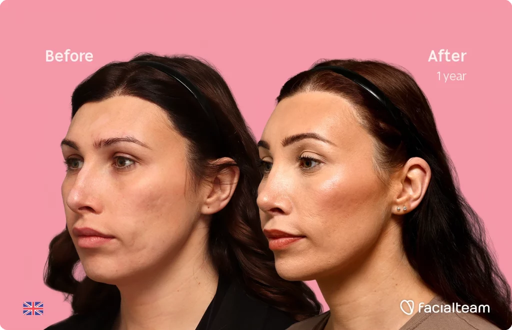 Side-by-side before and after portrait showing improved skin tone and contour after one year (pink background).