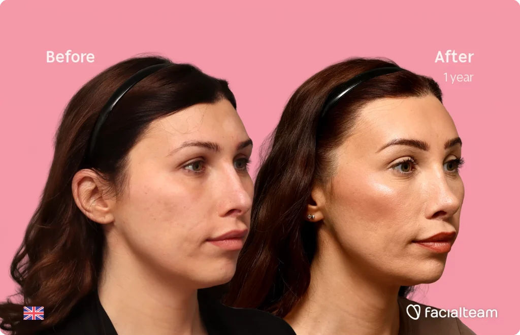 Before/after comparison of a woman's face after skincare treatment; left shows uneven skin, right shows smoother, glowing skin (pink background).