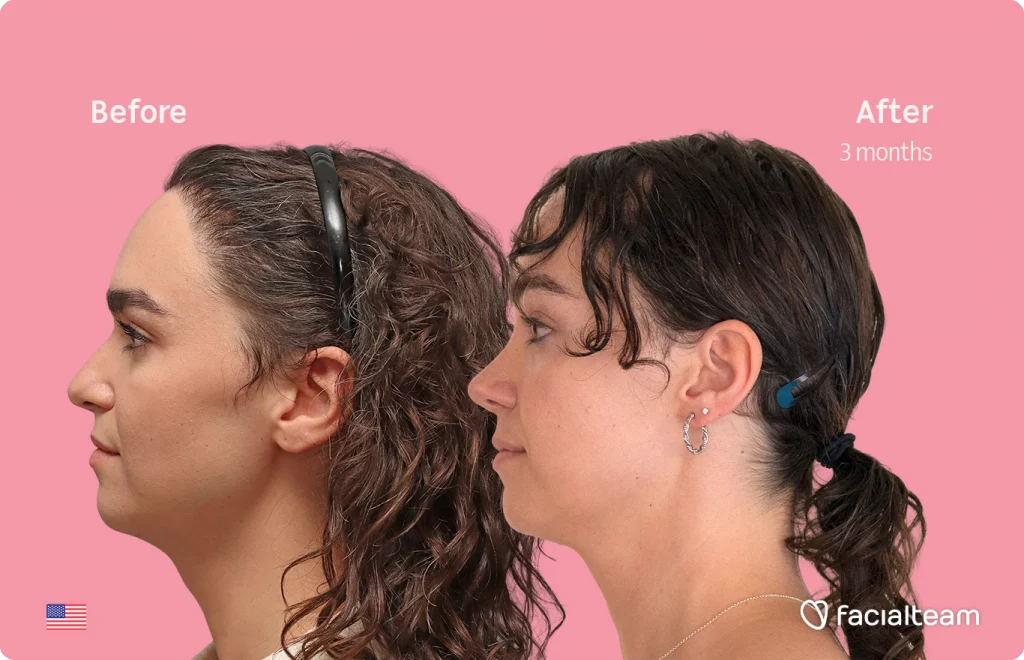 Before/after side-by-side photos of a woman's face showing cosmetic improvement over three months against a pink background; labels read 'Before' and 'After 3 months'.