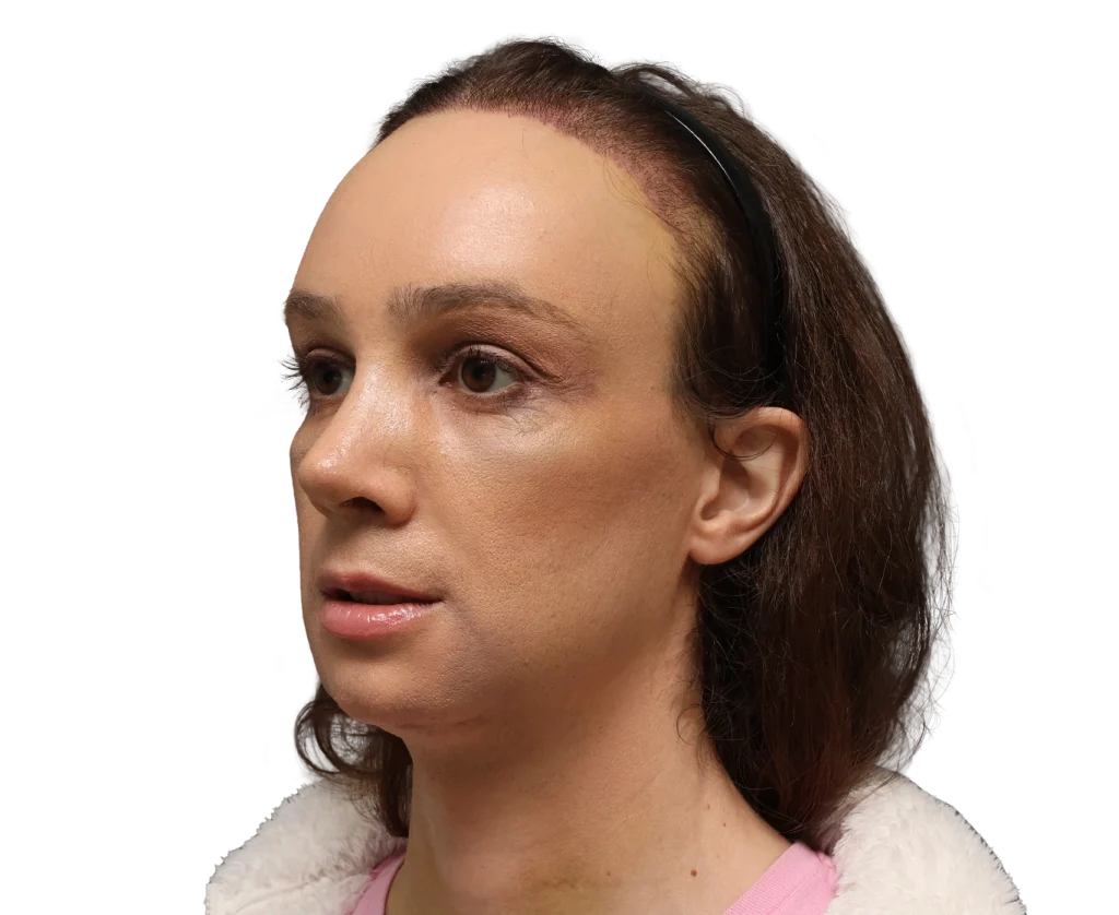 Close-up of a woman's head in profile, brown hair pulled back with a thin headband, wearing a pink top and white fleece.