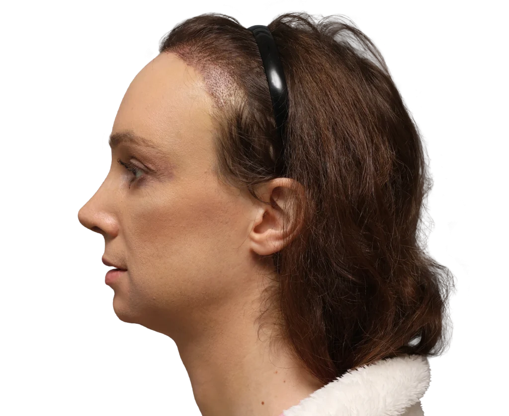 Profile view of a woman with brown hair wearing a black headband, facing left against a plain background.