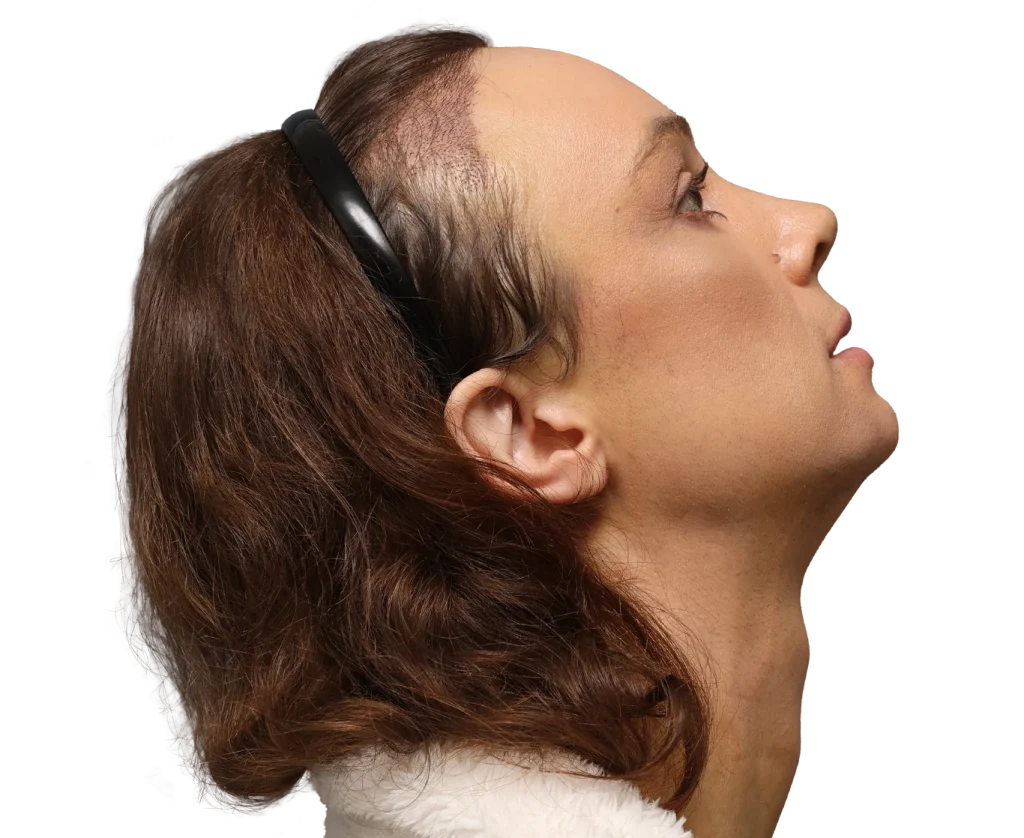 Side-profile of a person wearing black over-ear headphones, looking upward, with brown hair and a white fur-collared garment partially visible.