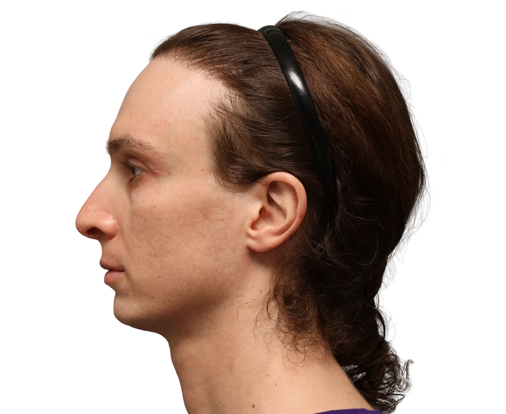 Profile view of a person with brown hair pulled back under a black headband, facing left.