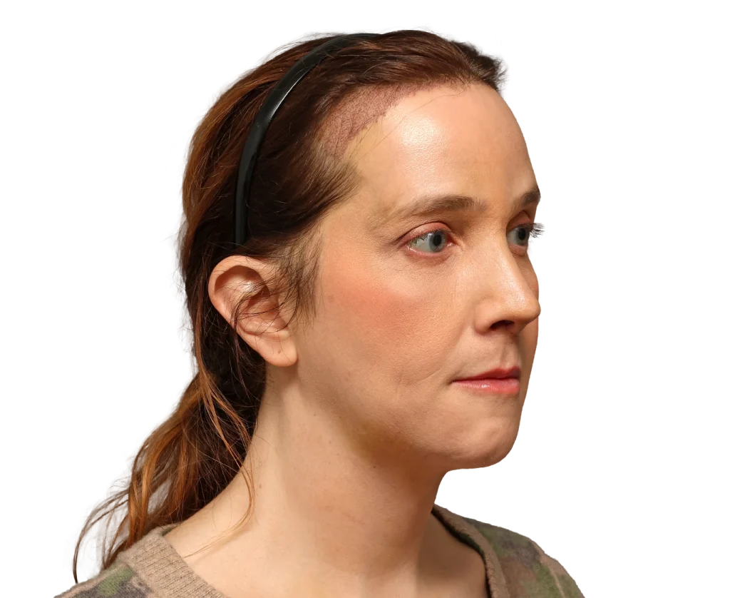 Side profile of a woman with brown hair pulled back, wearing a black headset and looking to the right.
