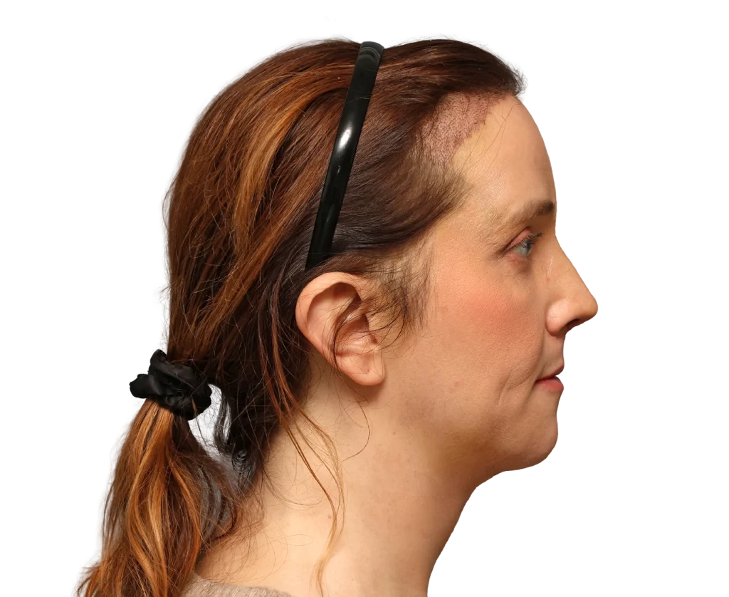 Side profile of a woman facing right with reddish-brown hair pulled back by a black hairband.