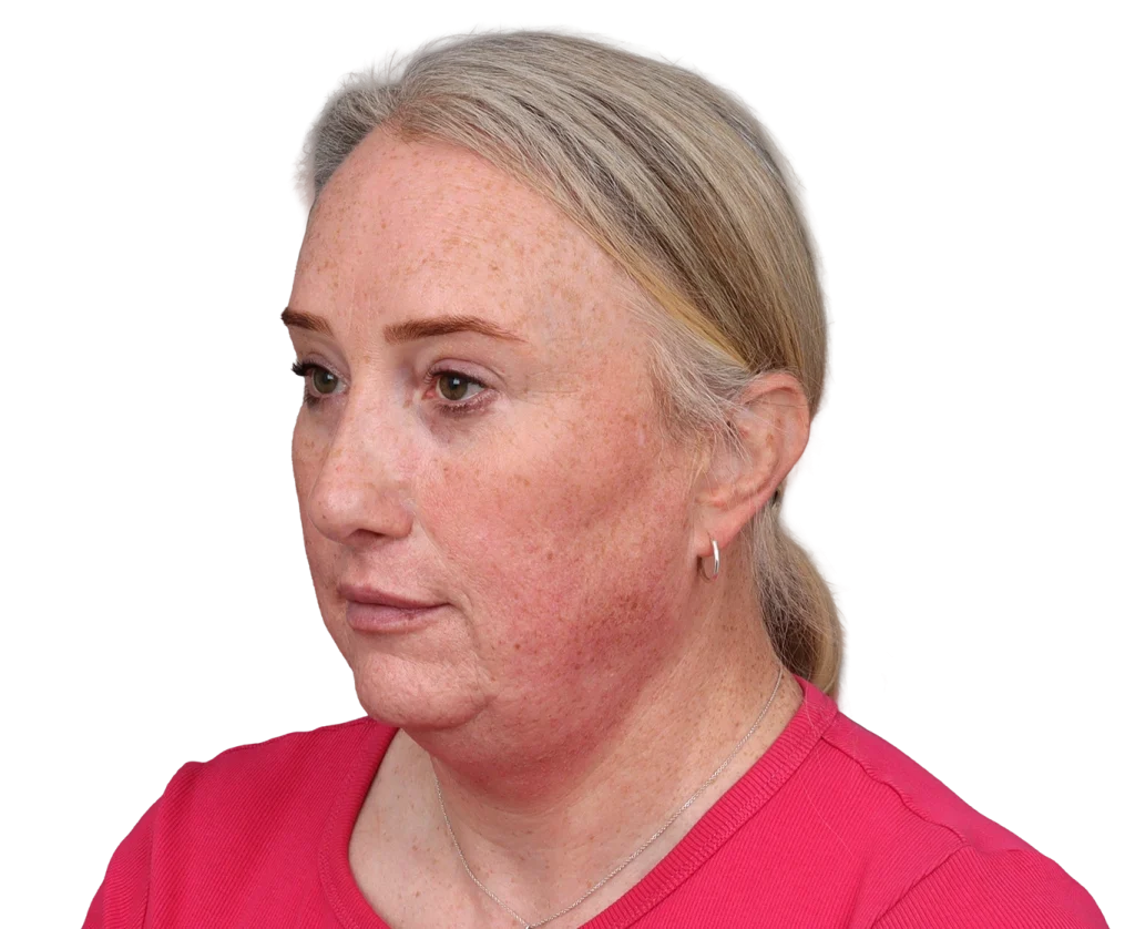 Profile of a middle-aged woman with light skin and freckles wearing a pink shirt, facing left.