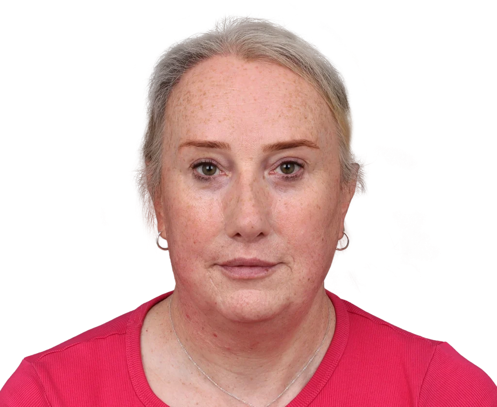 Front-facing portrait of a middle-aged woman with light gray hair, freckles, and a pink top, looking straight at the camera with a neutral expression.