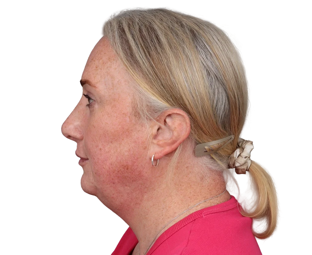 Side profile of a middle-aged woman with blonde hair tied in a ponytail, visible freckles, wearing a pink top and small hoop earring.