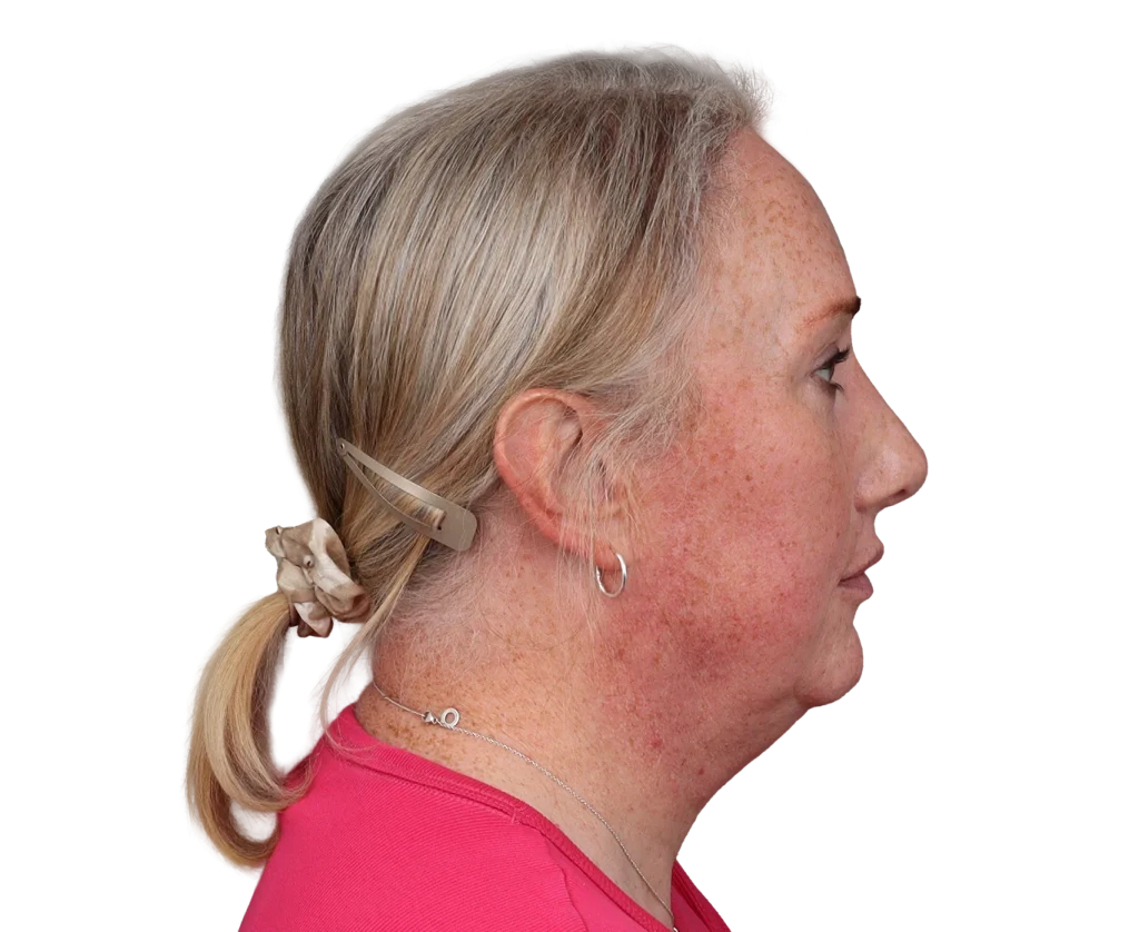 Side profile of a middle-aged woman with blond hair tied back, wearing a beige hair clip and pink top.