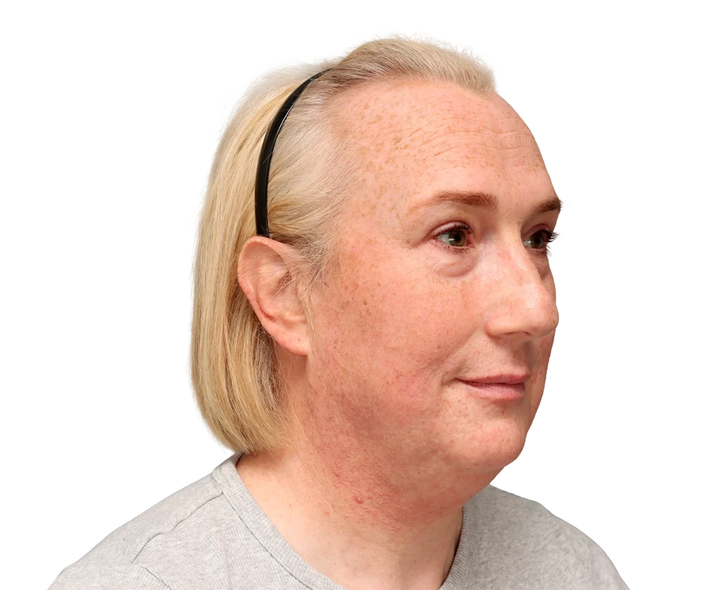Side profile of a blonde woman with freckles, wearing a gray shirt and sunglasses resting on her head.