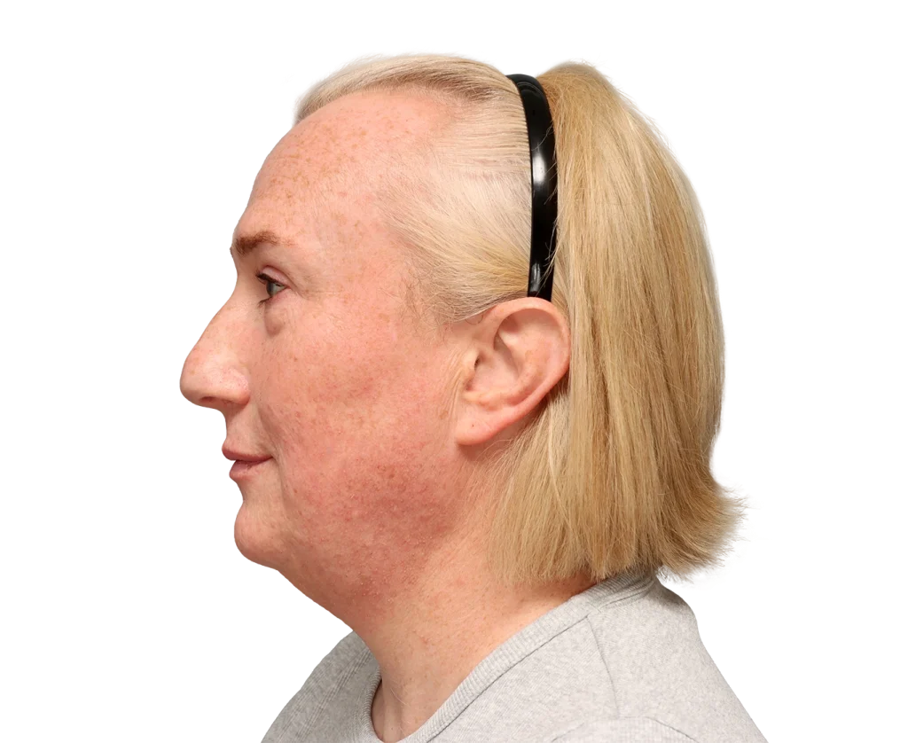Side profile of a middle-aged woman with freckled skin and light blonde hair, wearing a black headband and gray shirt.