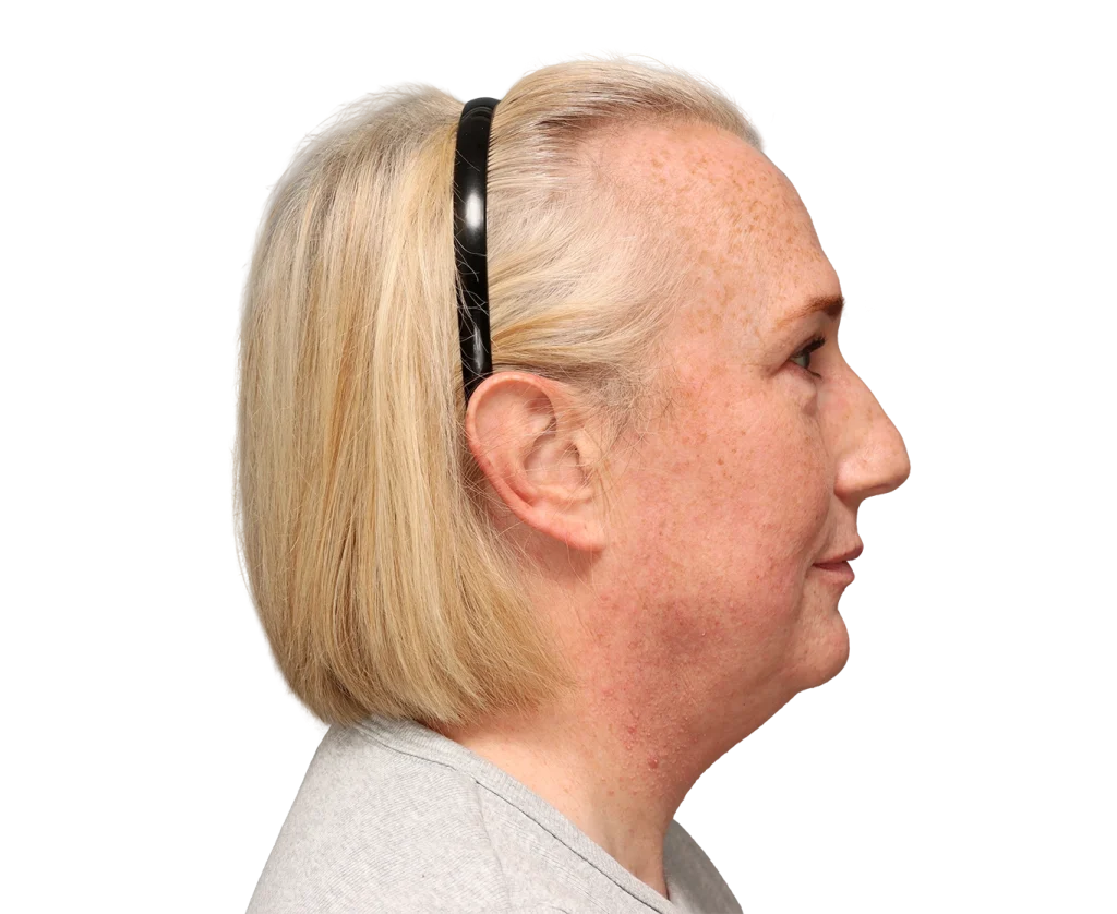 Profile view of a blonde woman wearing a black headband, facing right, with freckles on her cheek and neck