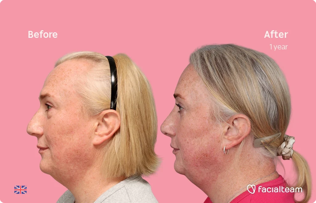 Before and after comparison of a woman's face; smoother skin and reduced redness after one year, pink background.