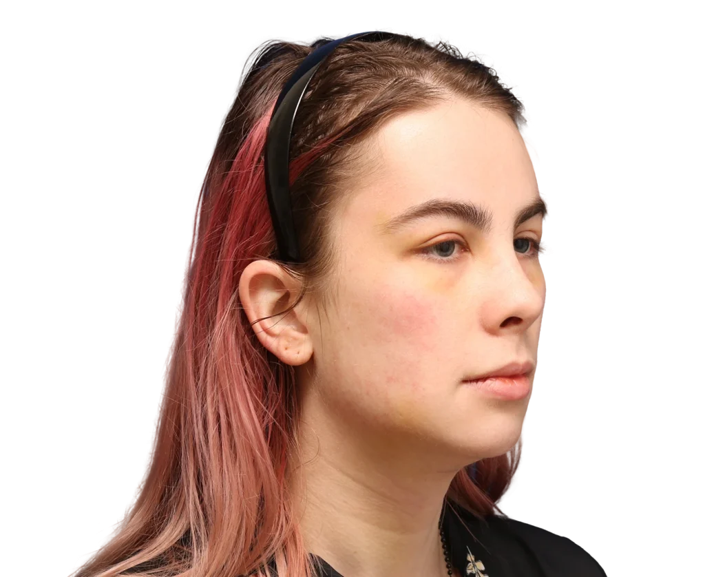 Side-profile of a young woman with pink-tinted hair wearing a black headband, looking to the right.