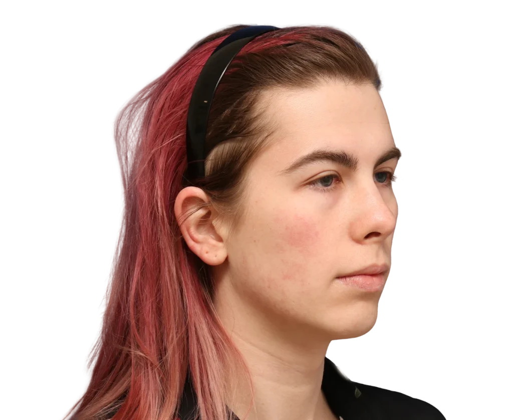 Side profile of a young woman with pink-dyed hair wearing a black headband, looking straight ahead with a neutral expression.