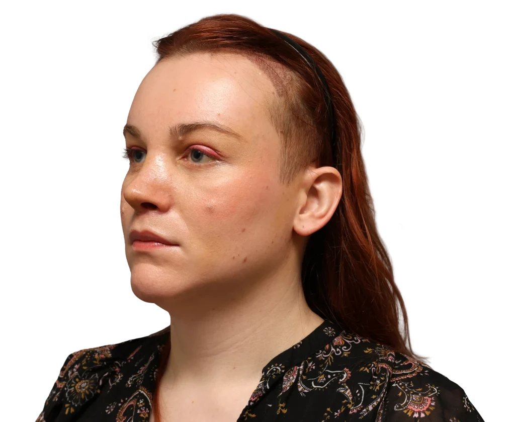 Profile view of a woman with red hair, wearing a black headband and a dark floral blouse, facing left.