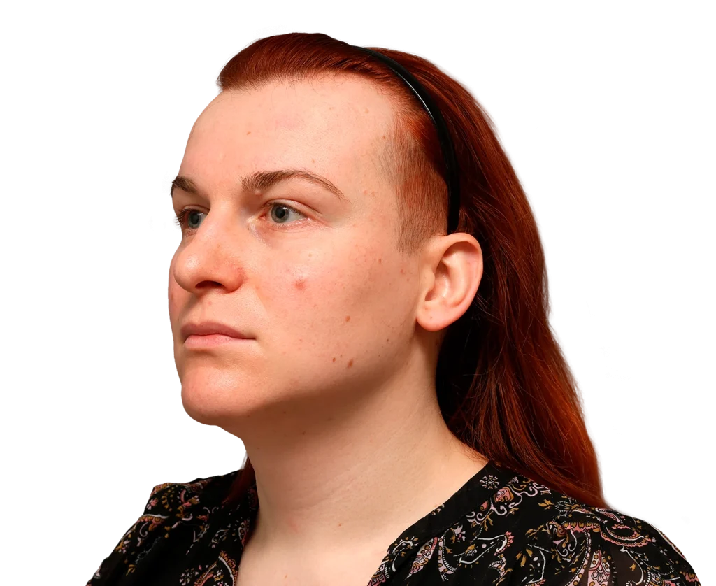 Woman in a black floral top, in left-facing profile with red hair held back by a black headband.